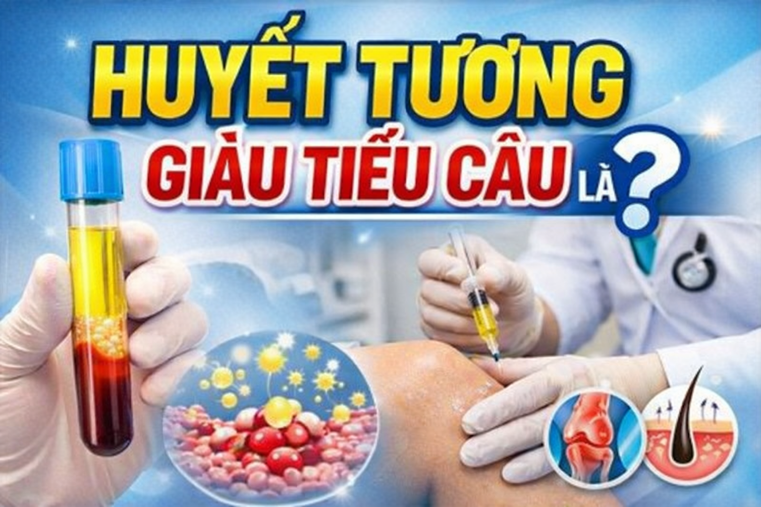 TIÊM HUYẾT TƯƠNG GIÀU TIỂU CẦU LÀ GÌ?
